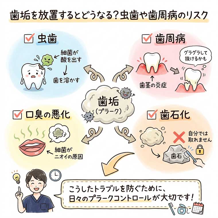 歯垢を放置するとどうなる？虫歯や歯周病のリスクの図解