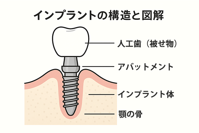 構造と図解