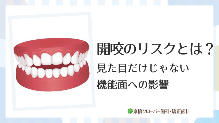 開咬のリスクとは？