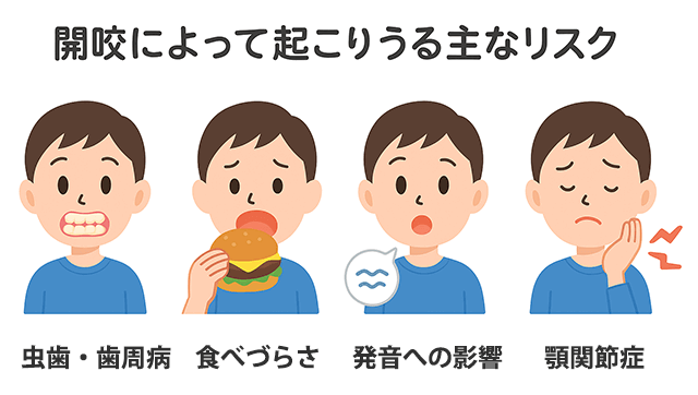 開咬の主なリスク