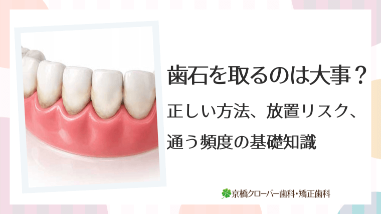 歯石を取るのは大事？正しい方法、放置リスク、通う頻度の基礎知識