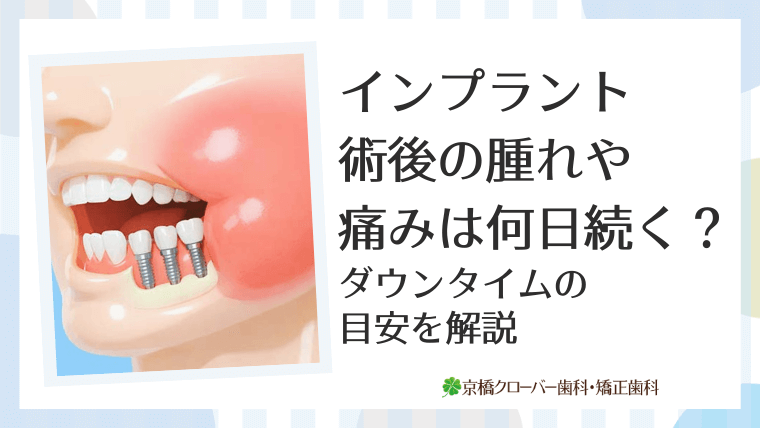 インプラント術後の腫れや痛みは何日続く？ダウンタイムの目安を解説