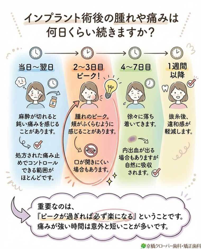 インプラント術後の腫れや痛みは何日くらい続きますか？