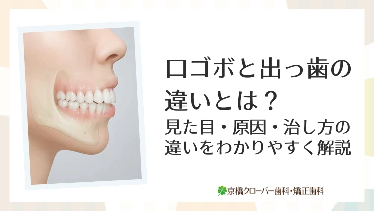 口ゴボと出っ歯の違いとは？見た目・原因・治し方の違いをわかりやすく解説
