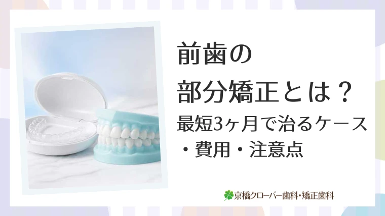 前歯の部分矯正とは？最短3ヶ月で治るケース・費用・注意点