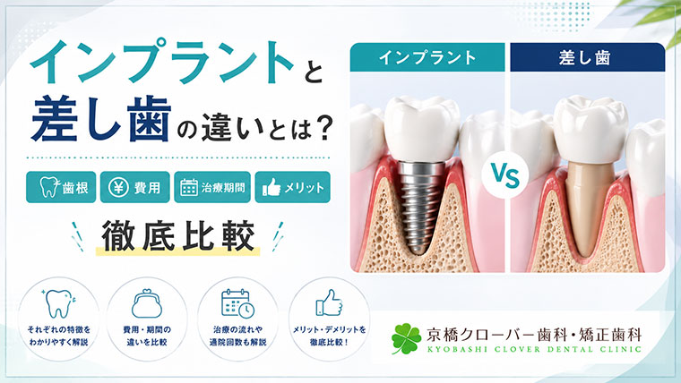 インプラントと差し歯の違いとは？歯根・費用・治療期間・メリットを徹底比較