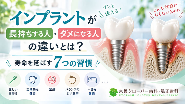 インプラントが長持ちする人・ダメになる人の違いとは？寿命を延ばす7つの習慣