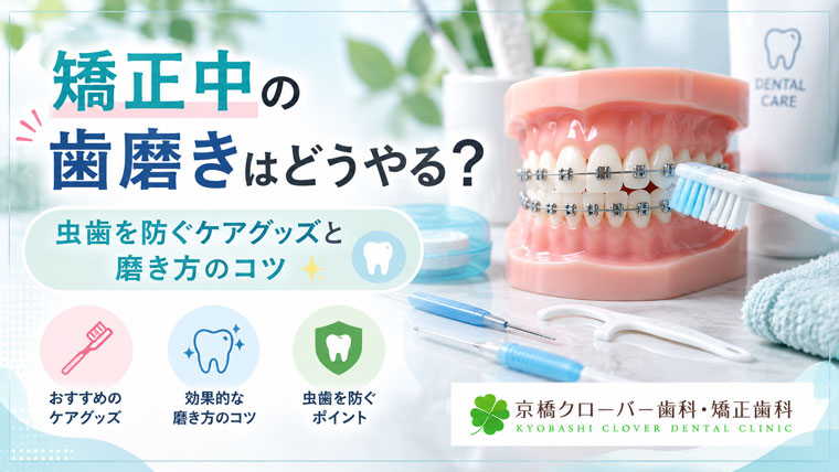 矯正中の歯磨きはどうやる？虫歯を防ぐケアグッズと磨き方のコツ