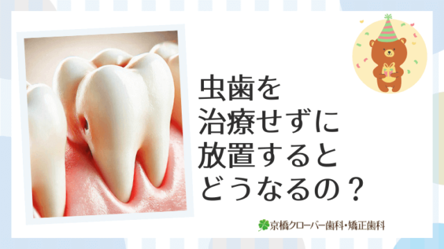 虫歯を治療せずに放置するとどうなるの？