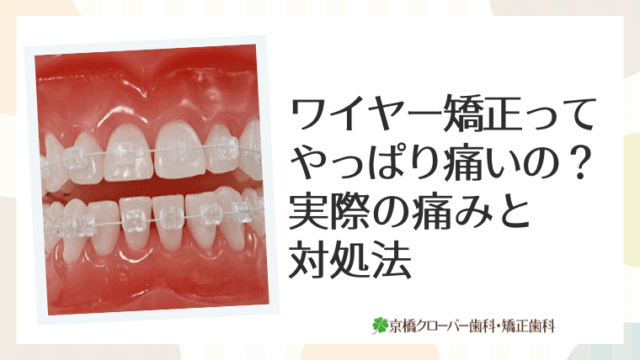 ワイヤー矯正ってやっぱり痛いの？実際の痛みと対処法