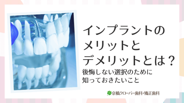 インプラントのメリットとデメリットとは？