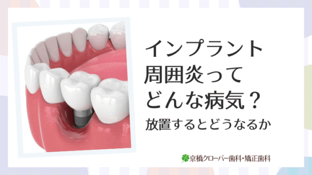インプラント周囲炎ってどんな病気？