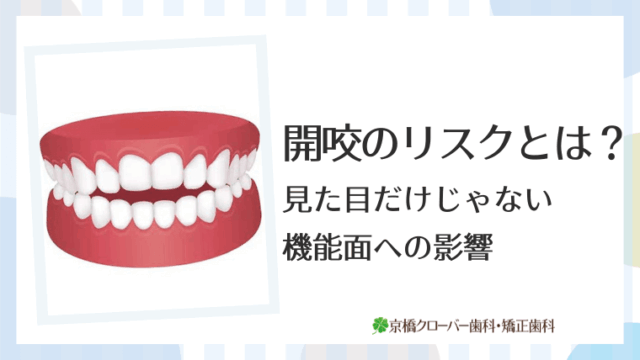 開咬のリスクとは？