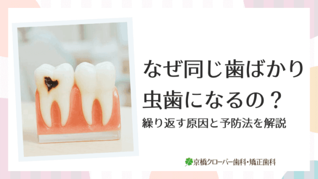 なぜ同じ歯ばかり虫歯になるの？
