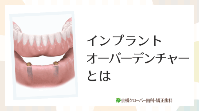 インプラントオーバーデンチャーとは
