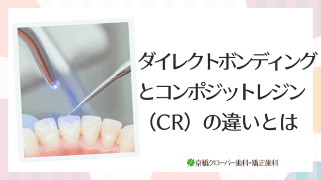 ダイレクトボンディングとコンポジットレジン（CR）の違いとは