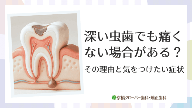 深い虫歯でも痛くない場合がある？