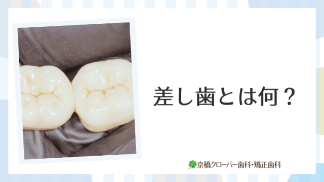差し歯とは何？