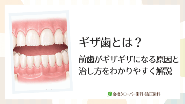 ギザ歯とは？前歯がギザギザになる原因と治し方をわかりやすく解説