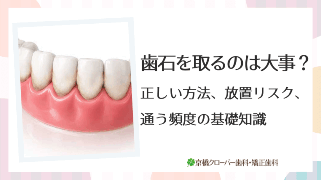 歯石を取るのは大事？正しい方法、放置リスク、通う頻度の基礎知識