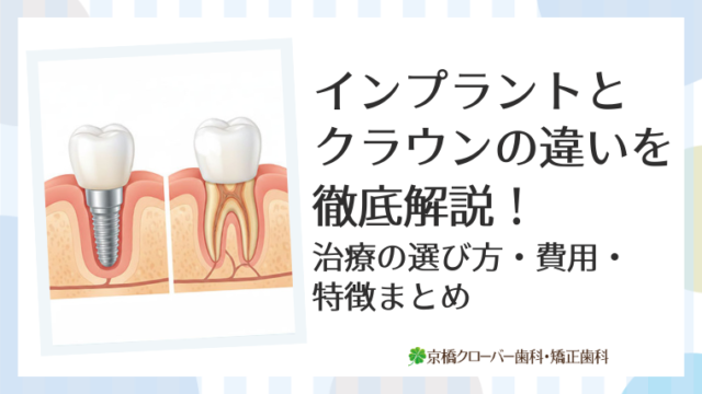 インプラントとクラウンの違いを徹底解説！治療の選び方・費用・特徴まとめ