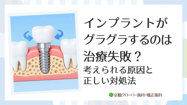 インプラントがグラグラするのは治療失敗？考えられる原因と正しい対処法