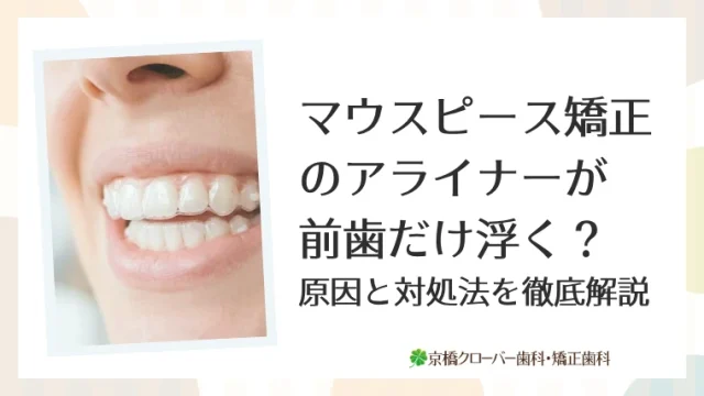 マウスピース矯正で前歯だけ浮く？原因と対処法を徹底解説