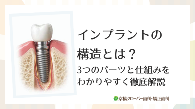 インプラントの構造とは？3つのパーツと仕組みをわかりやすく徹底解説