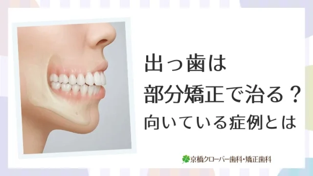 出っ歯は部分矯正で治る？向いている症例とは
