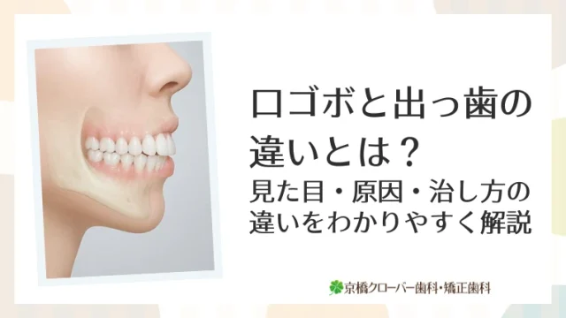 口ゴボと出っ歯の違いとは？見た目・原因・治し方の違いをわかりやすく解説