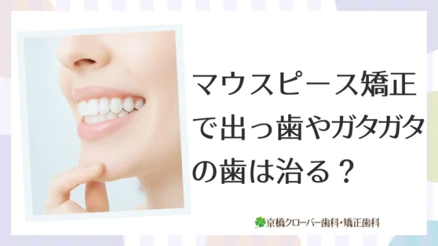 マウスピース矯正で出っ歯やガタガタの歯は治る？適応症例・治療期間・抜歯の必要性