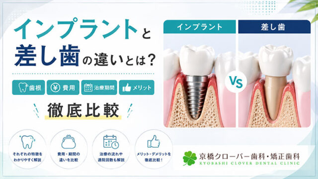 インプラントと差し歯の違いとは？歯根・費用・治療期間・メリットを徹底比較