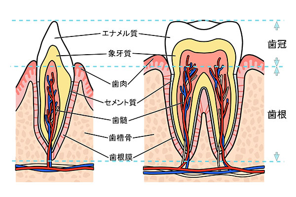 虫歯の原因