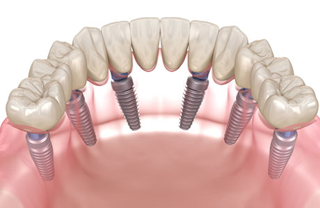 相談する歯科医師