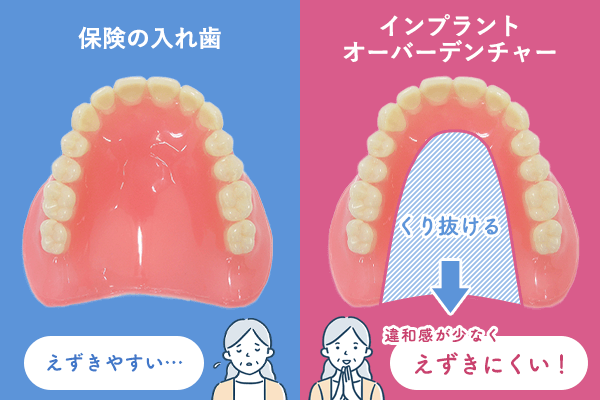 磁性アタッチメント