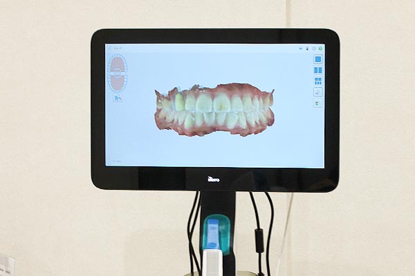 最新の口腔内スキャナー「iTero エレメント 5D Plus」を導入