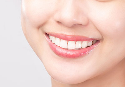 セラミック矯正