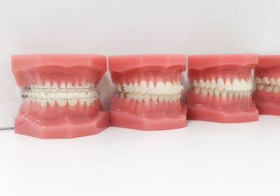 矯正歯科トップ