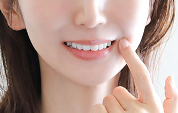 セラミック矯正