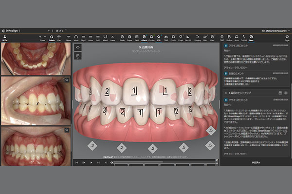 3Dシミュレーション