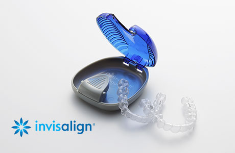 インビザラインの信頼性