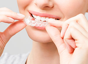 マウスピースを装着する口元