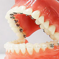 ハーフリンガル