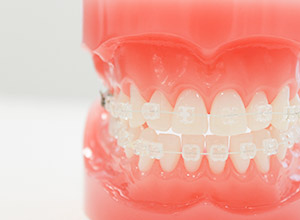 歯の模型と時計