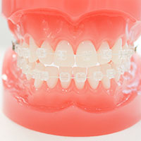 ホワイトワイヤー矯正/審美矯正